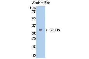 Western Blotting (WB) image for anti-Sema Domain, Seven Thrombospondin Repeats (Type 1 and Type 1-Like), Transmembrane Domain (TM) and Short Cytoplasmic Domain, (Semaphorin) 5B (SEMA5B) (AA 350-602) antibody (ABIN1860526) (SEMA5B antibody  (AA 350-602))