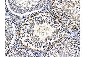 ABIN7096340 and ABIN7100402 at 1/100 staining rat testis tissue by IHC-P. (RDH8 antibody)