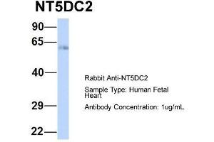 Host:  Rabbit  Target Name:  NT5DC2  Sample Type:  Human Fetal Heart  Antibody Dilution:  1. (NT5DC2 antibody  (N-Term))