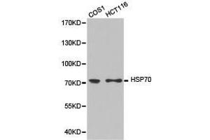 Western Blotting (WB) image for anti-Heat Shock Protein 70 (HSP70) antibody (ABIN1873094)