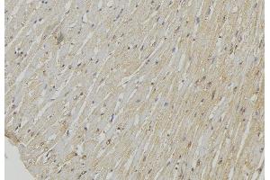 ABIN6278540 at 1/100 staining Mouse muscle tissue by IHC-P. (UCP2 antibody  (Internal Region))