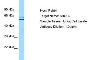 Host: RabbitTarget Name: SHOC2Antibody Dilution: 1. (SHoc2/Sur8 antibody  (N-Term))