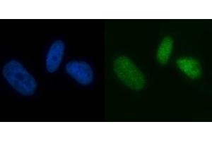 IF analysis of MCM7 using anti-MCM7 antibody (ABIN7601968).