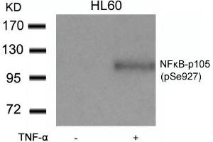 Western blot analysis of extracts from HL60 cells untreated or treated with TNF-a using NFkB-p105(Phospho-Ser927) Antibody. (NFKB1 antibody  (pSer927))
