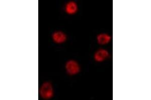 ABIN6275322 staining HepG2 by IF/ICC. (NRBF2 antibody  (Internal Region))