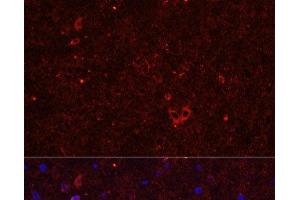 Immunofluorescence analysis of Rat brain using GRIA2 Polyclonal Antibody at dilution of 1:50. (GRIA2 antibody)