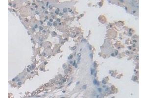 Immunohistochemistry (IHC) image for anti-Isocitrate Dehydrogenase 2 (NADP+), Mitochondrial (IDH2) (AA 40-452) antibody (ABIN7441520)