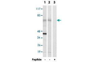 Western blot analysis of extracts from NIH/3T3 cells (Lane 1) and RAW 264. (ME3 antibody)