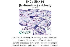 Image no. 2 for anti-Sorting Nexin 16 (SNX16) (N-Term) antibody (ABIN1739488) (SNX16 antibody  (N-Term))
