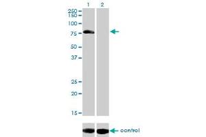 Western blot analysis of AKAP10 over-expressed 293 cell line, cotransfected with AKAP10 Validated Chimera RNAi (Lane 2) or non-transfected control (Lane 1).
