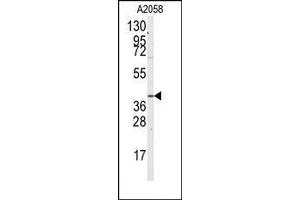 Image no. 1 for anti-Guanine Nucleotide Binding Protein (G Protein) alpha 12 (GNA12) (Ser67) antibody (ABIN360476) (GNA12 antibody  (Ser67))