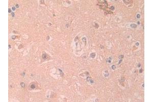 DAB staining on IHC-P; Samples: Human Cerebrum Tissue (IL1RAPL2 antibody  (AA 161-330))