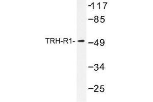 Image no. 1 for anti-Thyrotropin-Releasing Hormone Receptor (TRHR) antibody (ABIN317876) (TRHR antibody)