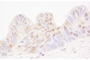 Immunohistochemistry (IHC) image for anti-Methyl-CpG Binding Domain Protein 4 (MBD4) (AA 1-50) antibody (ABIN7448644) (MBD4 antibody  (AA 1-50))