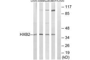 Western blot analysis of extracts from LOVO cells, A549 cells, HUVEC cells and MCF-7 cells, using HOXB2 antibody.