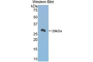 Western Blotting (WB) image for anti-alpha-1-B Glycoprotein (A1BG) (AA 220-415) antibody (ABIN1857838)