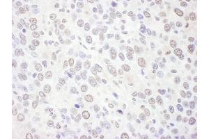 anti-Exosome Component 10 (EXOSC10) (AA 200-250) antibody
