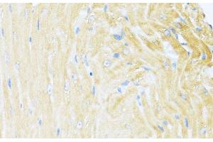 Immunohistochemistry of paraffin-embedded Mouse heart using UQCC2 Polyclonal Antibody at dilution of 1:100 (40x lens). (MNF1 antibody)