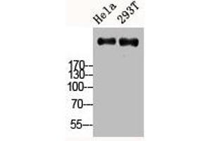 Western Blot analysis of HELA 293T cells using Ki-67 Polyclonal Antibody (Ki-67 antibody  (C-Term))