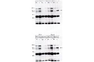 Image no. 1 for anti-Vav 2 Guanine Nucleotide Exchange Factor (VAV2) antibody (ABIN264963)
