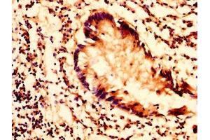 IHC image of ABIN7163362 diluted at 1:200 and staining in paraffin-embedded human appendix tissue performed on a Leica BondTM system. (PLTP antibody  (AA 18-493))