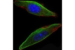 Immunofluorescent analysis of 4 % paraformaldehyde-fixed, 0. (CSF1R antibody  (C-Term))