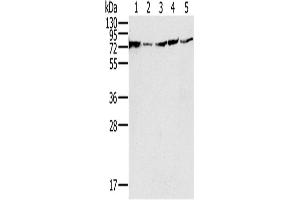 Western Blotting (WB) image for anti-NADH Dehydrogenase (Ubiquinone) Fe-S Protein 1, 75kDa (NADH-Coenzyme Q Reductase) (NDUFS1) antibody (ABIN2430526) (NDUFS1 antibody)