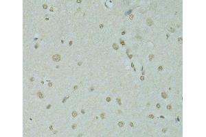 Immunohistochemistry of paraffin-embedded Rat brain using SAFB Polyclonal Antibody at dilution of 1:100 (40x lens).