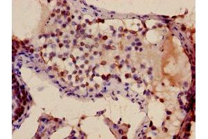 Immunohistochemistry of paraffin-embedded human testis tissue using ABIN7172499 at dilution of 1:100 (TFDP3 antibody  (AA 61-196))