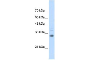 WB Suggested Anti-HOXB4 Antibody Titration:  0. (HOXB4 antibody  (C-Term))