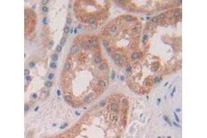 Used in DAB staining on fromalin fixed paraffin- embedded Kidney tissue (PRDM14 antibody  (AA 395-568))