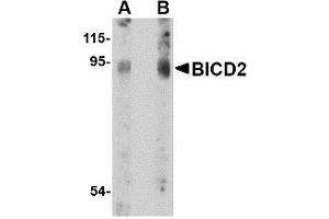 Western blot analysis of BICD2 in A549 cell lysate with AP30145PU-N BICD2 antibody at (A) 1 and (B) 2 μg/ml.