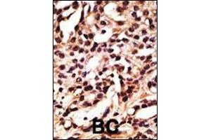 Immunohistochemistry (Paraffin-embedded Sections) (IHC (p)) image for anti-Autophagy Related 12 (ATG12) (AA 1-30), (N-Term) antibody (ABIN388536)