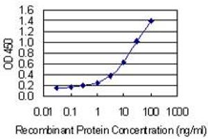 Detection limit for recombinant GST tagged PLS3 is 0. (Plastin 3 antibody  (AA 1-630))