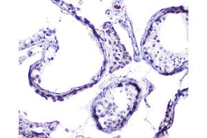 IHC analysis of Hsp105 using anti-Hsp105 antibody (ABIN5693036).