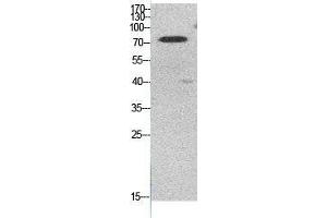 Western Blot (WB) analysis of HeLa cells using Acetyl-Ub (K48) Polyclonal Antibody. (Ubiquitin antibody  (acLys48))