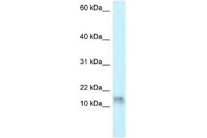 Western Blot showing DNAL1 antibody used at a concentration of 1 ug/ml against HepG2 Cell Lysate (DNAL1 antibody  (N-Term))
