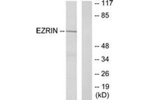Western blot analysis of extracts from A431 cells, treated with EGF 200ng/ml 30', using Ezrin (Ab-353) Antibody. (Ezrin antibody  (AA 321-370))
