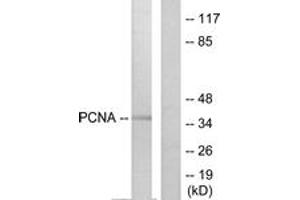 Western blot analysis of extracts from HepG2 cells, using PCNA Antibody. (PCNA antibody  (AA 61-110))