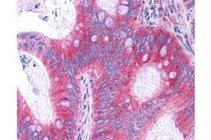Antibody  has been tested in immunohistochemistry, analyzed by an anatomic pathologist and validated for use in IHC applications against formalin-fixed, paraffin-embedded human tissues. (NF-kB p65 antibody  (C-Term))