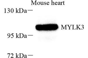 Western blot analysis of MYLK3 (ABIN7074736) at dilution of 1: 800 (MYLK3 antibody)