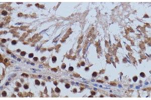 Immunohistochemistry of paraffin-embedded Rat testis using BRD4 Polyclonal Antibody at dilution of 1:100 (40x lens). (BRD4 antibody)