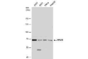 Western Blotting (WB) image for anti-Replication Protein A1, 70kDa (RPA1) (C-Term) antibody (ABIN2856633)