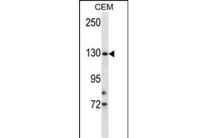 TRSS9 Antibody (N-term) (ABIN657932 and ABIN2846876) western blot analysis in CEM cell line lysates (35 μg/lane).
