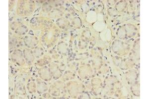 Immunohistochemistry of paraffin-embedded human pancreatic tissue using ABIN7144554 at dilution of 1:100 (ACAP1 antibody  (AA 1-266))