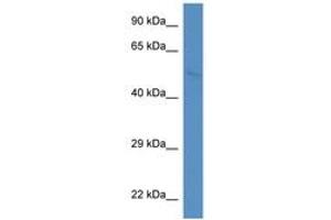 Image no. 1 for anti-WAS Protein Family, Member 2 (WASF2) (AA 146-195) antibody (ABIN6746329) (WASF2 antibody  (AA 146-195))