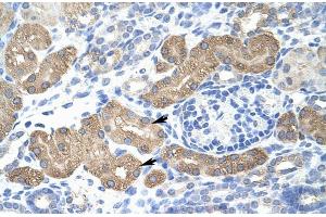 Human kidney; Rabbit Anti-L3MBTL2 Antibody. (L3MBTL2 antibody  (C-Term))