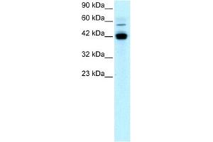 WB Suggested Anti-EGR1 Antibody Titration: 1 ug/ml Positive Control: Jurkat cell lysate (EGR1 antibody  (N-Term))