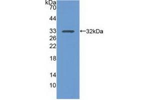 Detection of Recombinant ITGa1, Human using Polyclonal Antibody to Integrin Alpha 1 (ITGa1) (Integrin alpha 1 antibody  (AA 125-366))