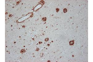 Immunostaining of paraffin embedded brain section from an Alzheimer's patient (dilution 1 : 100). (Abeta 1-42 antibody  (AA 37-42))